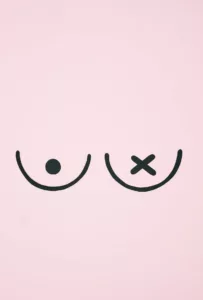 Read more about the article ഇംപ്ലാന്റ് അടിസ്ഥാനമാക്കിയുള്ള സ്തന പുനർനിർമ്മാണത്തിന് ശേഷം അണുബാധയുടെ അപകടസാധ്യതകൾ പ്രവചിക്കാൻ ആർട്ടിഫിഷ്യൽ ഇന്റലിജൻസ് സഹായിച്ചേക്കാം